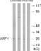 ADP Ribosylation Factor 4 antibody, LS-C119701, Lifespan Biosciences, Western Blot image 