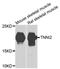 Troponin I2, Fast Skeletal Type antibody, A7937, ABclonal Technology, Western Blot image 