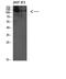 Unc-51 Like Autophagy Activating Kinase 2 antibody, STJ98597, St John
