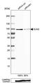 Sad1 And UNC84 Domain Containing 2 antibody, PA5-51539, Invitrogen Antibodies, Western Blot image 