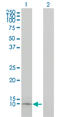 Apolipoprotein C1 antibody, LS-C196671, Lifespan Biosciences, Western Blot image 