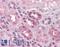 Proprotein Convertase Subtilisin/Kexin Type 6 antibody, LS-B4377, Lifespan Biosciences, Immunohistochemistry paraffin image 