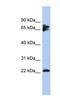Protein Phosphatase 3 Regulatory Subunit B, Alpha antibody, NBP1-56816, Novus Biologicals, Western Blot image 