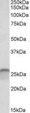 Calbindin 1 antibody, EB11759, Everest Biotech, Western Blot image 