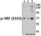 Serum Response Factor antibody, A00557S103, Boster Biological Technology, Western Blot image 