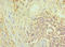 NCK Adaptor Protein 1 antibody, LS-C376206, Lifespan Biosciences, Immunohistochemistry paraffin image 