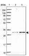 Zinc Finger Protein 771 antibody, PA5-61277, Invitrogen Antibodies, Western Blot image 