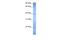 Zinc Finger Protein 121 antibody, A17672, Boster Biological Technology, Western Blot image 