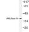 Aldolase, Fructose-Bisphosphate A antibody, LS-C176720, Lifespan Biosciences, Western Blot image 