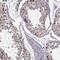 Checkpoint with forkhead and RING finger domains protein antibody, NBP2-68970, Novus Biologicals, Immunohistochemistry paraffin image 