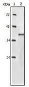 Insulin Like Growth Factor 1 Receptor antibody, M00070, Boster Biological Technology, Western Blot image 