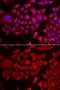 Threonyl-TRNA Synthetase antibody, GTX65852, GeneTex, Immunofluorescence image 