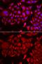 SYTC antibody, GTX65852, GeneTex, Immunofluorescence image 