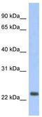 Mitochondrially Encoded NADH:Ubiquinone Oxidoreductase Core Subunit 6 antibody, TA342087, Origene, Western Blot image 