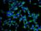 Clathrin Light Chain A antibody, 10852-1-AP, Proteintech Group, Immunofluorescence image 