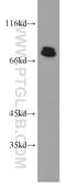 AT-rich interactive domain-containing protein 3A antibody, 14068-1-AP, Proteintech Group, Western Blot image 