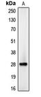 CCAAT Enhancer Binding Protein Delta antibody, LS-C351982, Lifespan Biosciences, Western Blot image 