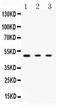 Protein Kinase CAMP-Dependent Type I Regulatory Subunit Alpha antibody, PA5-79867, Invitrogen Antibodies, Western Blot image 