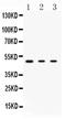 Protein Kinase CAMP-Dependent Type I Regulatory Subunit Alpha antibody, PA5-79867, Invitrogen Antibodies, Western Blot image 