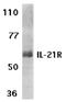 Interleukin 21 Receptor antibody, LS-C403, Lifespan Biosciences, Western Blot image 