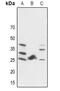 Fibroblast Growth Factor 19 antibody, GTX56182, GeneTex, Western Blot image 
