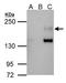 Erb-B2 Receptor Tyrosine Kinase 4 antibody, GTX111276, GeneTex, Immunoprecipitation image 