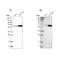 Prolyl 4-Hydroxylase Subunit Alpha 1 antibody, NBP1-84398, Novus Biologicals, Western Blot image 