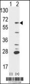 Protein Tyrosine Phosphatase Non-Receptor Type 6 antibody, 61-522, ProSci, Western Blot image 