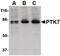 Tyrosine-protein kinase-like 7 antibody, PA5-20425, Invitrogen Antibodies, Western Blot image 