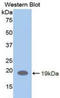 LIF Receptor Subunit Alpha antibody, LS-C301316, Lifespan Biosciences, Western Blot image 