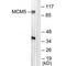 Minichromosome Maintenance Complex Component 5 antibody, PA5-49747, Invitrogen Antibodies, Western Blot image 