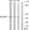 Aldolase, Fructose-Bisphosphate A antibody, abx013358, Abbexa, Western Blot image 