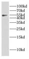 Cytoplasmic Polyadenylation Element Binding Protein 1 antibody, FNab01917, FineTest, Western Blot image 