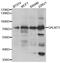 Polypeptide N-acetylgalactosaminyltransferase 3 antibody, abx005058, Abbexa, Western Blot image 