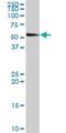 Sphingomyelin Phosphodiesterase Acid Like 3B antibody, H00027293-D01P, Novus Biologicals, Western Blot image 