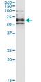 Dihydropyrimidinase Like 4 antibody, MA5-21089, Invitrogen Antibodies, Immunoprecipitation image 