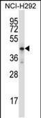 Homeobox D10 antibody, PA5-48685, Invitrogen Antibodies, Western Blot image 