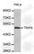 Thyroid Hormone Receptor Interactor 6 antibody, A3336, ABclonal Technology, Western Blot image 