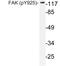 Protein Tyrosine Kinase 2 antibody, LS-C177998, Lifespan Biosciences, Western Blot image 