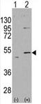 Aldehyde Dehydrogenase 5 Family Member A1 antibody, AP11468PU-N, Origene, Western Blot image 