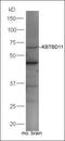 Keratin 35 antibody, orb184572, Biorbyt, Western Blot image 