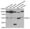 Pyruvate Dehyrogenase Phosphatase Catalytic Subunit 1 antibody, LS-C334646, Lifespan Biosciences, Western Blot image 