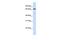 Acyl-CoA Synthetase Long Chain Family Member 5 antibody, GTX16578, GeneTex, Western Blot image 