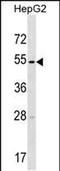 Transmembrane Serine Protease 11E antibody, PA5-48775, Invitrogen Antibodies, Western Blot image 