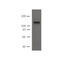 Desmoglein 2 antibody, IQ579, Immuquest, Western Blot image 