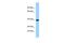 Toll Like Receptor Adaptor Molecule 2 antibody, PA5-46067, Invitrogen Antibodies, Western Blot image 