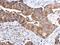 Thymic Stromal Lymphopoietin antibody, GTX129591, GeneTex, Immunohistochemistry paraffin image 