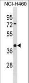 Ubiquitin C-Terminal Hydrolase L5 antibody, LS-C157014, Lifespan Biosciences, Western Blot image 