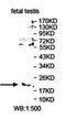 Teratocarcinoma-Derived Growth Factor 1 antibody, orb78360, Biorbyt, Western Blot image 