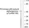 Phosphoinositide-3-Kinase Regulatory Subunit 1 antibody, PA5-38903, Invitrogen Antibodies, Western Blot image 